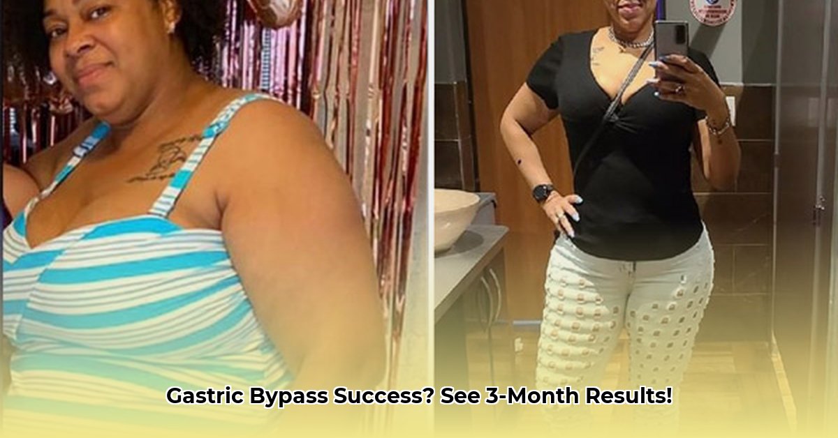 weight-loss-after-gastric-bypass-3-months
